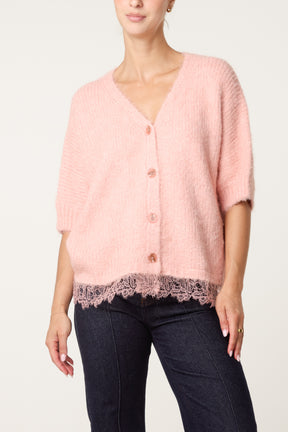 Cardigan With Lace Trim